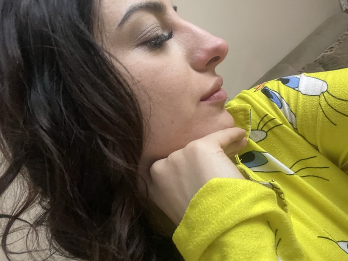 Sizce burnum ameliyat çilesi çekecek kadar büyük mü?