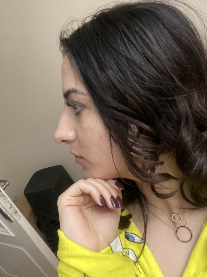 Sizce burnum ameliyat çilesi çekecek kadar büyük mü?
