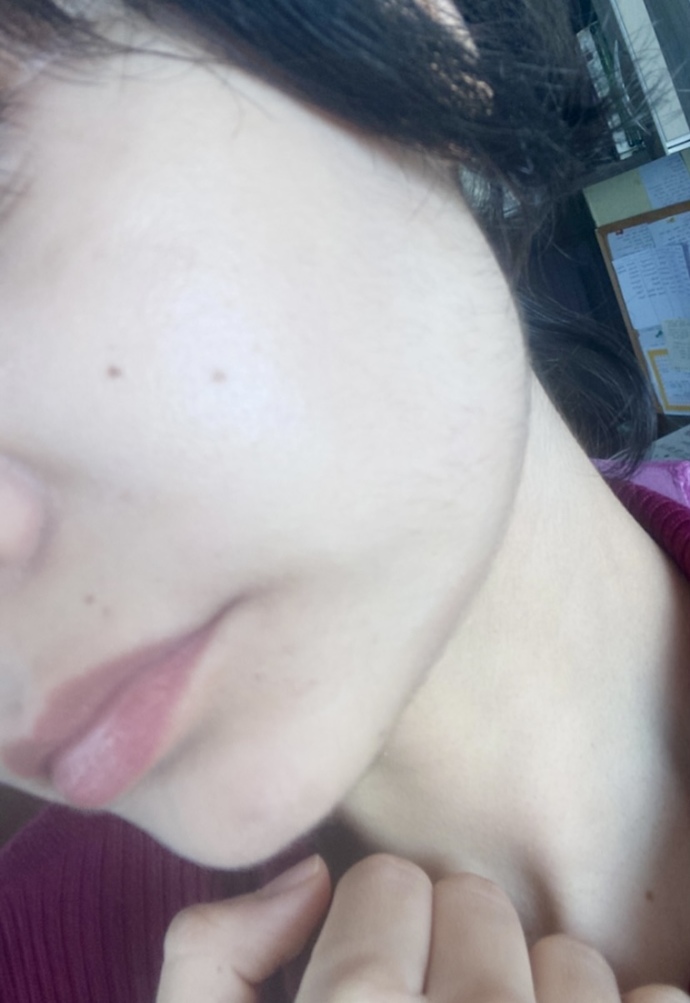 Pirinç suyu tüy çikartir mi ya yüzüme deniyordum ama hafif tüylenme oldu gibi🙃?