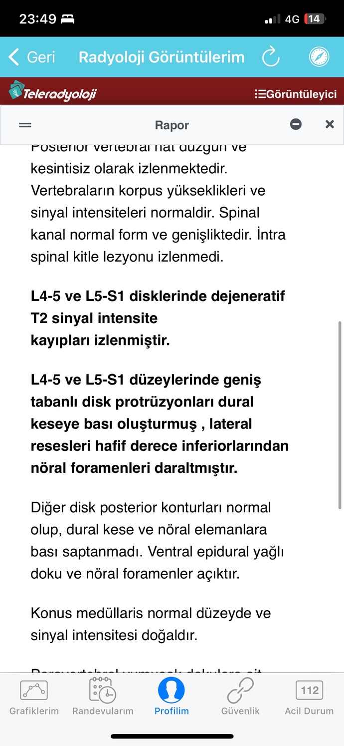 Bel fıtığımın şu anki durumunu bana ayrıntılı açıklayacak bir babayiğit var mı?