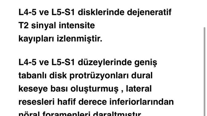 Bel fıtığımın şu anki durumunu bana ayrıntılı açıklayacak bir babayiğit var mı?