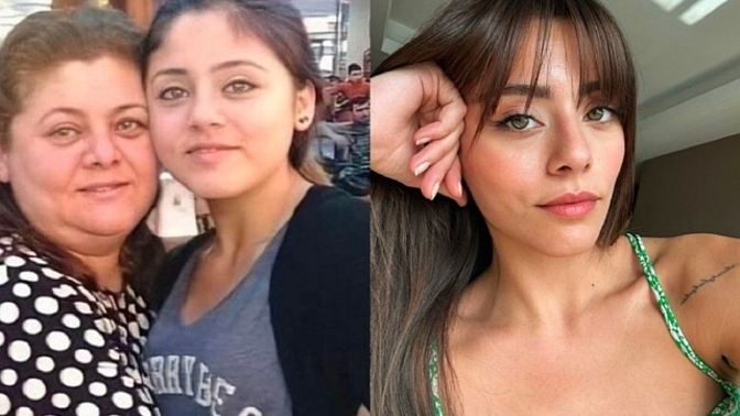 Oyuncu #SılaTürkoğlu, yüzünde estetik olmadığını söyledi. Sizce oyuncunun değişimi estetikten mi kaynaklı, büyümekten mi?