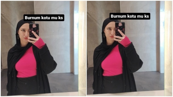 Burnum çok mu kötü?