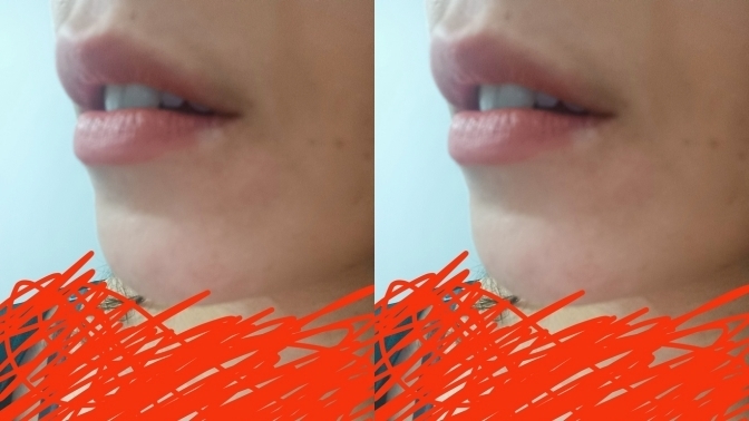 Dudaklarımın dolguya sizce ihtiyacı var mı? Çok mu ince?