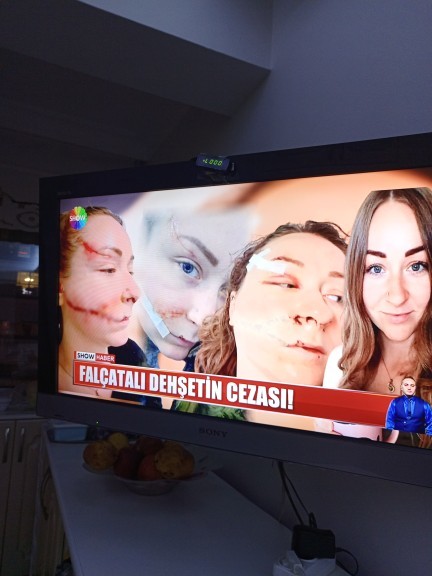 Erkolar neden çiçek almıyorsunuz?