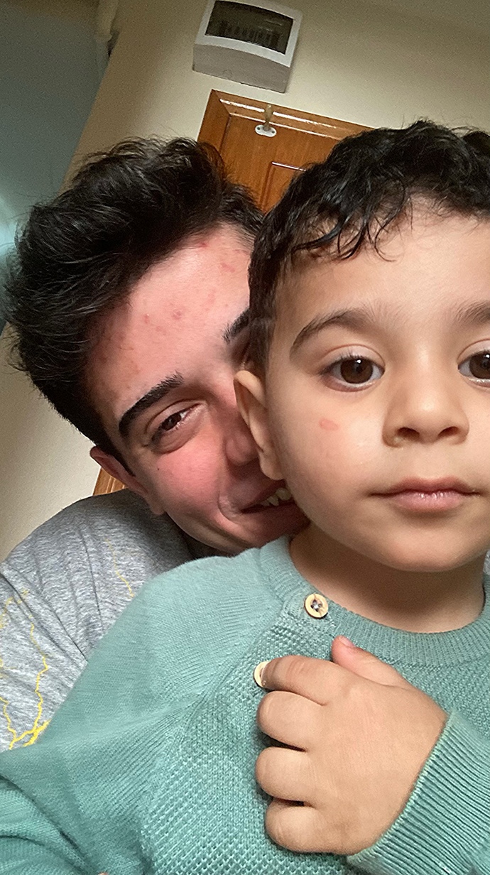 İnsan Kardeşini Neden Çok Sever?
