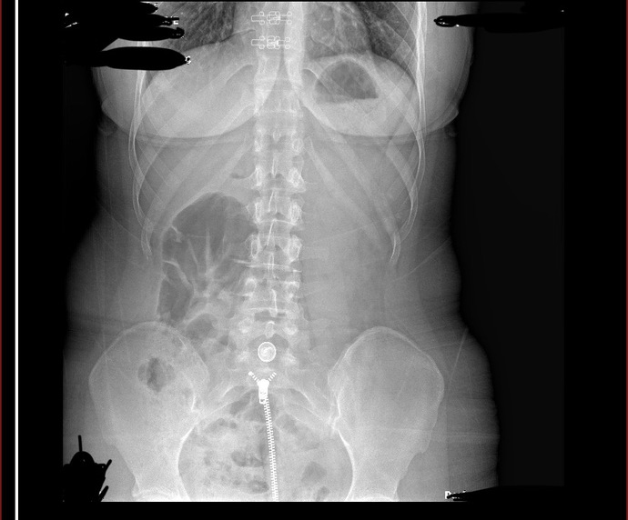 RÖNTGENDEN ANLAYAN YA DA DOKTOR OLAN VAR MI?
