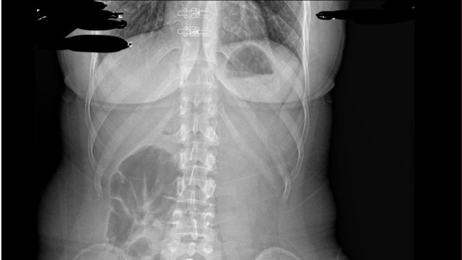 RÖNTGENDEN ANLAYAN YA DA DOKTOR OLAN VAR MI?