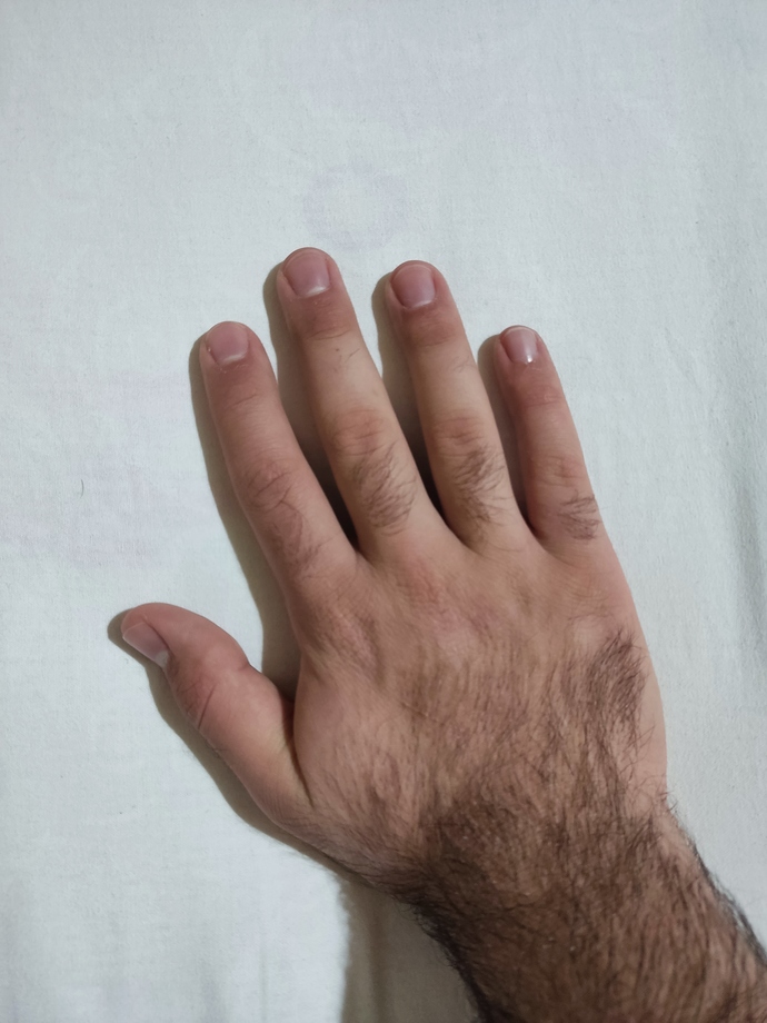 Ellerim yaşıma göre çok küçük, kafayı yiyeceğim. Yapabileceğim bir şey var mı 😓?