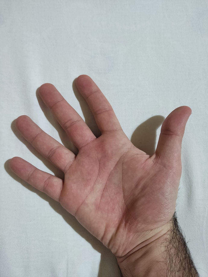 Ellerim yaşıma göre çok küçük, kafayı yiyeceğim. Yapabileceğim bir şey var mı 😓?