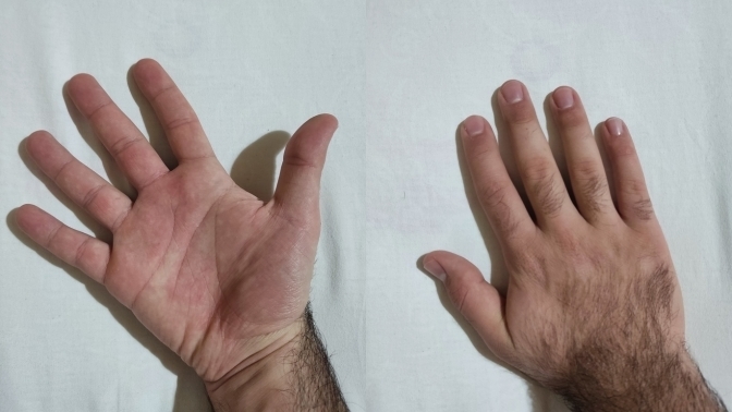 Ellerim yaşıma göre çok küçük, kafayı yiyeceğim. Yapabileceğim bir şey var mı 😓?