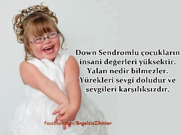 Bugün 21 Mart Dünya Down Sendromlular Farkındalık Günü! Onlar hakkında yeterli bilgiye sahip misiniz?