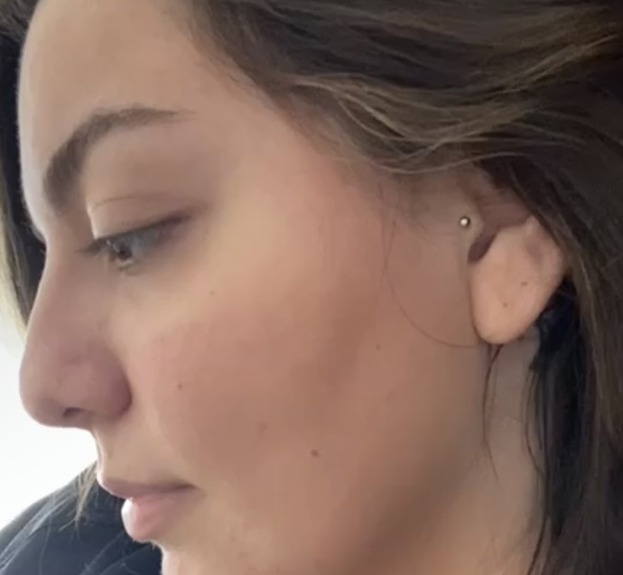 Burun estetiği yaptırmak istiyorum ama çok korkuyorum?