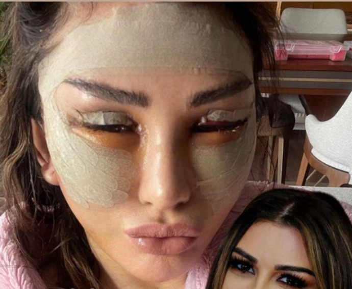 Ünlü şarkıcı Selen Görgüzel, estetik operasyonu geçirdi! Sence nasıl olmuş?