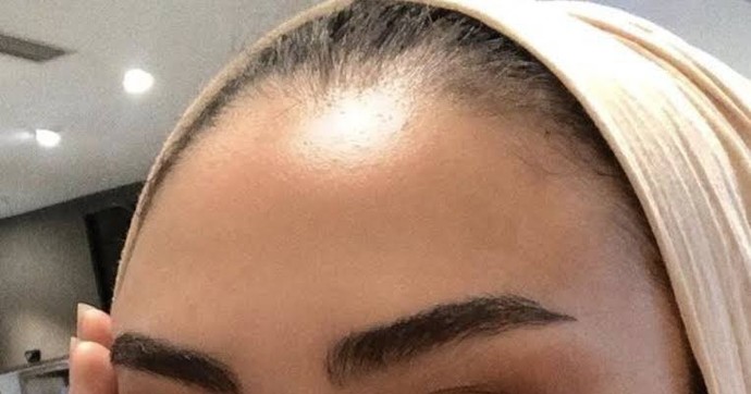 Tesettürlü çoğu kadın neden başının önünden saçını göstermeye başladı?