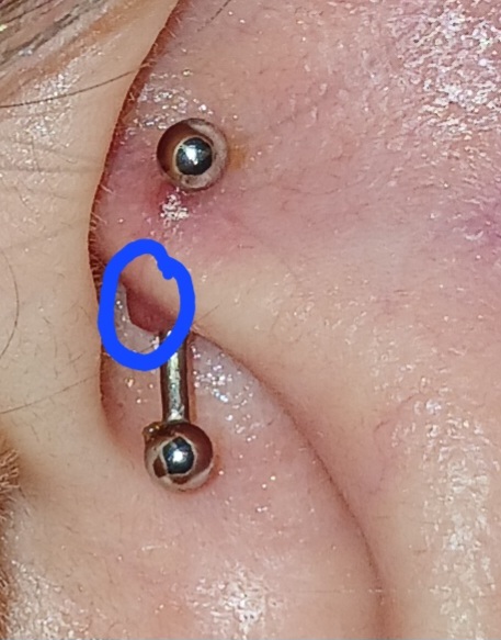 Kulak piercinginde bump nasıl geçer?