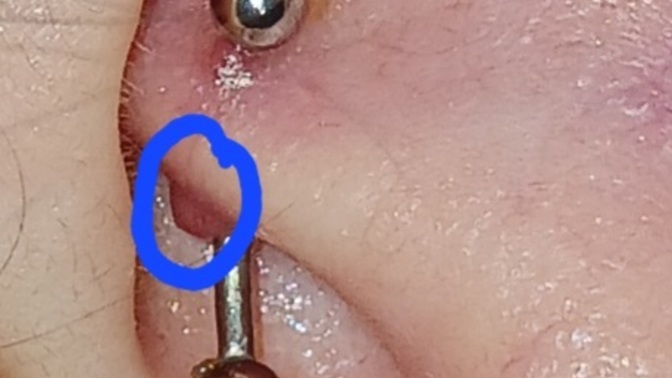 Kulak piercinginde bump nasıl geçer?