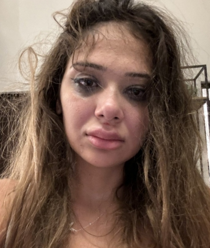 OnlyFans fenomeni Merve Taşkın, sevgilisinden şiddet gördüğünü açıkladı! Ne düşünüyorsunuz?