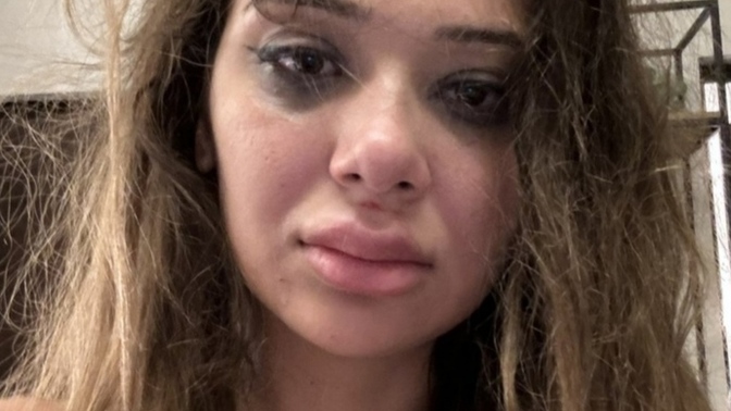 OnlyFans fenomeni Merve Taşkın, sevgilisinden şiddet gördüğünü açıkladı! Ne düşünüyorsunuz?