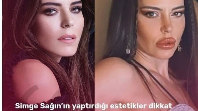 Simge Sağın'ın yeni halini nasıl buldunuz?
