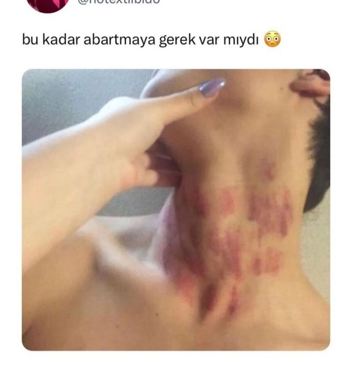Yanlış anlaşılma olmasın ama cidden nasıl kızlar böyle yapar?