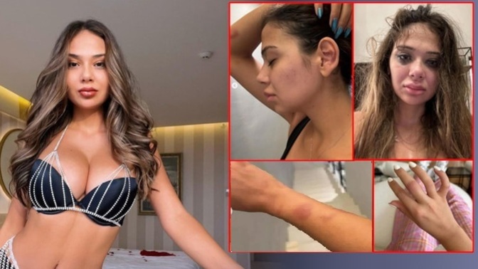 Şiddet gören Merve Taşkın'a gelen kötü yorumlar hakkında ne düşünüyorsun?
