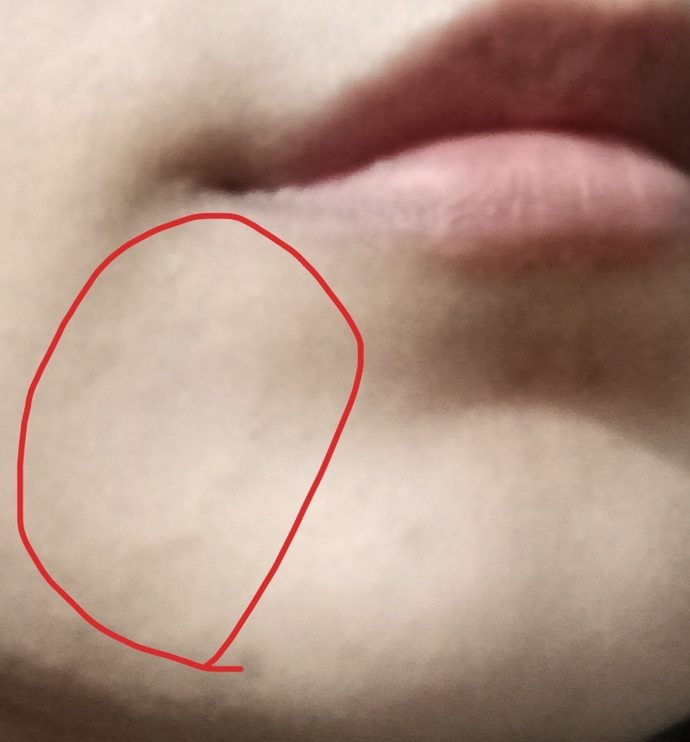 Cildiye randevu yok nerelere düştük help?