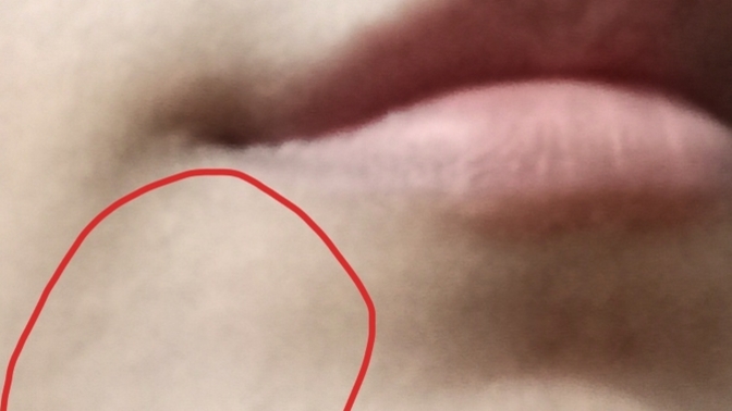 Cildiye randevu yok nerelere düştük help?