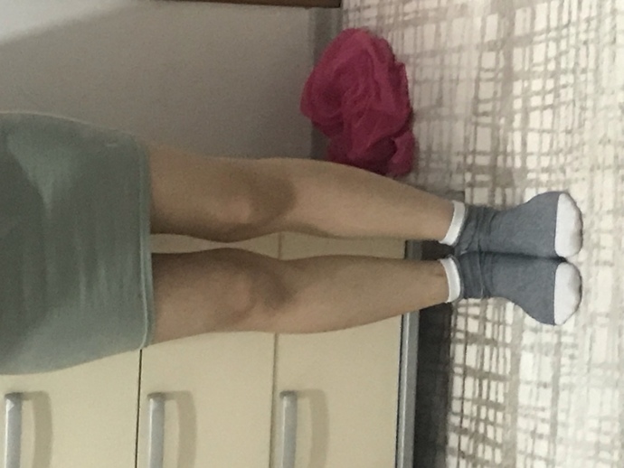 Elbise giymek istesem diz kapaklarım çok çıkık gibi duruyor yakışmıypr değil mi açık kıyafetler?/:?