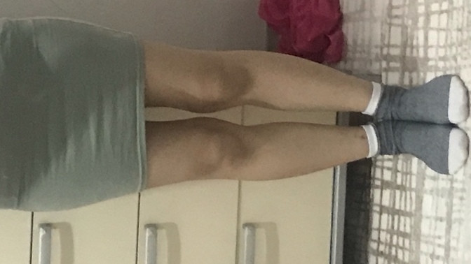 Elbise giymek istesem diz kapaklarım çok çıkık gibi duruyor yakışmıypr değil mi açık kıyafetler?/:?