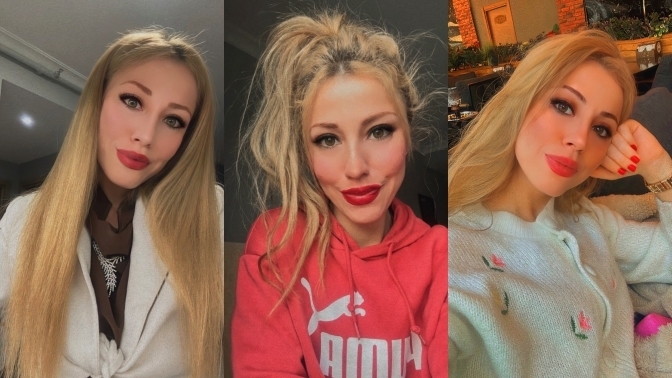 Eşimle boşandım. Sizce terk edilecek kadar çirkin miyim :(?