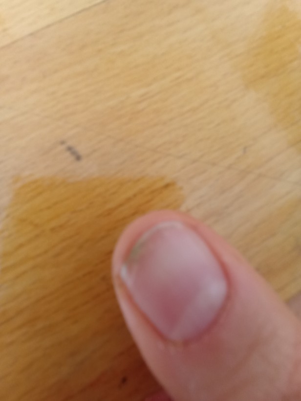 Tırnaklarım çok yıpranmış ne yapmalıyım?