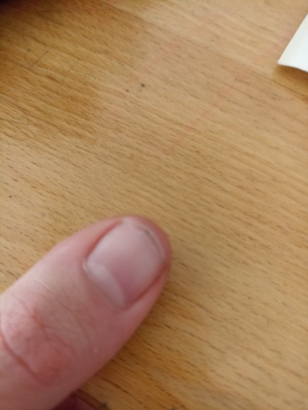 Tırnaklarım çok yıpranmış ne yapmalıyım?