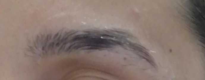 Kaşlarım aşırı dökülüyor 1. Fotoğraf normal ikincisi dökülmüş hali?