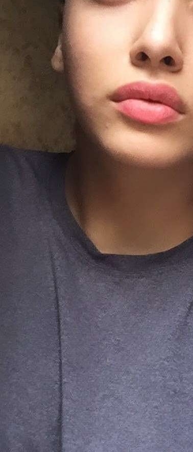 Burnum böyle nasıl duruyor?