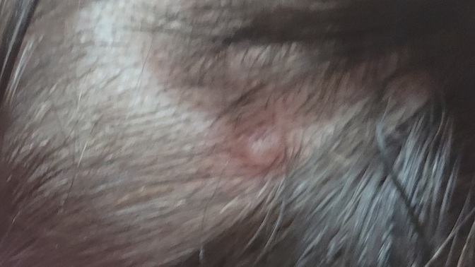 Kafamın bazı yerlerinde böyle şey var. Doktora gittim bana KONAZOL şampuanı tavsiye etti ama düzelmedu?