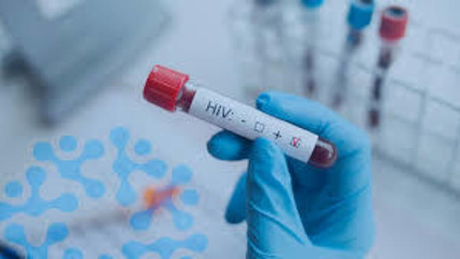HIV veya AIDS virüsünün bulaştığını nasıl anlarız?