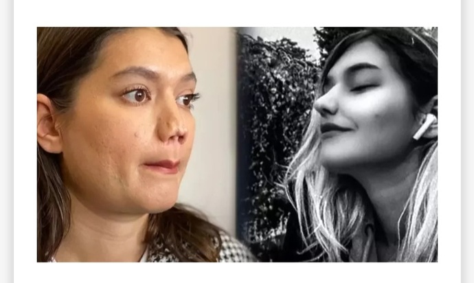 Estetik yaptırıpta pişman olduğunuz oldu mu?
