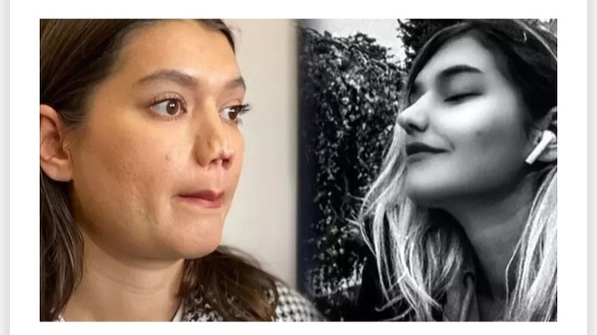 Estetik yaptırıpta pişman olduğunuz oldu mu?
