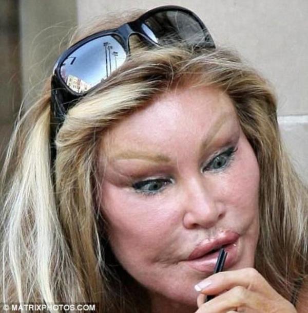 Jawline yaptırmak istiyorum fazla maskülen bir görüntü oluşturur mu?