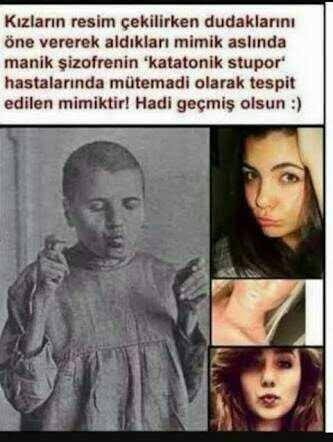 Poz verirken dudak büzer misiniz?