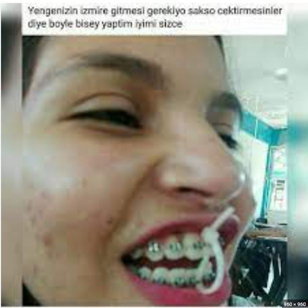 Diş teli cinsel hayatı olumsuz etkiler mi?