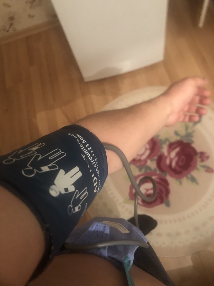 Yaşım 29 koluma tansiyon holter takılmıştı ve sonuçlar bu tansiyon çok mu yüksek normal mi durum?
