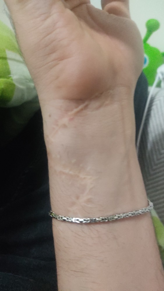 Vücudunda ben dövme piercing yara izi var mı?