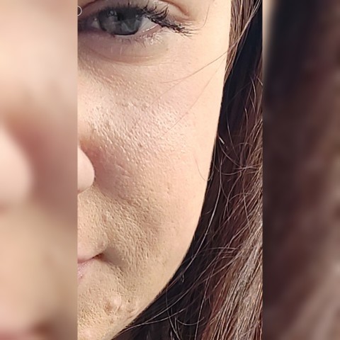 Arkadaşlar kuzenimin cildi böyle duruyor neden acaba nasıl düzelecek?