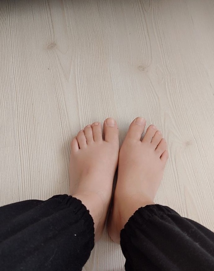 Ayaklarım sürekli şiş gibi duruyor nasıl geçer?