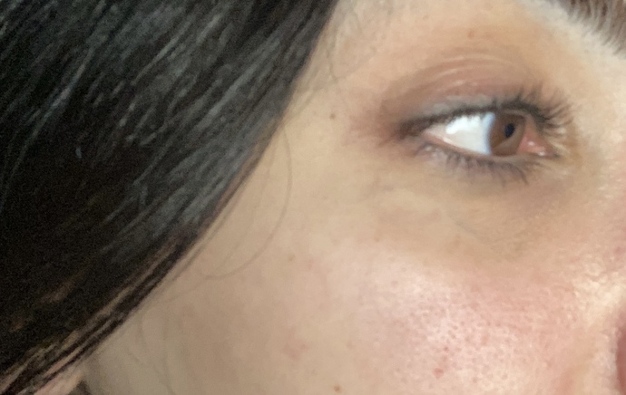 Göz çevremde mi morluk nasıl geçer ve gözenek görüntüsünü nasıl yol edebilirim :((((?