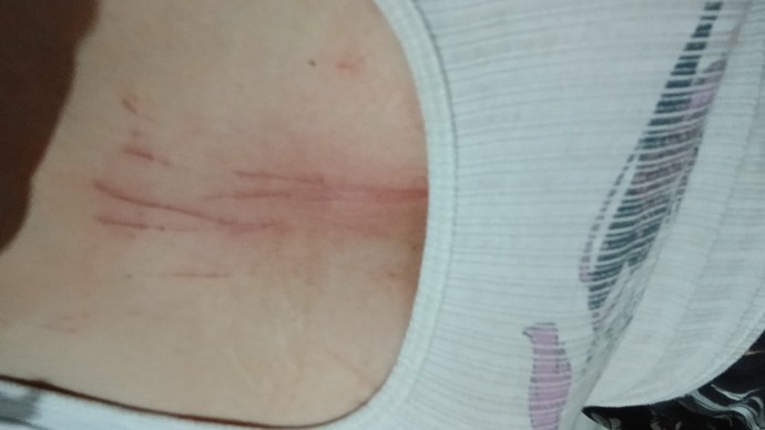 Kedim çizdi iltihap akıyor?