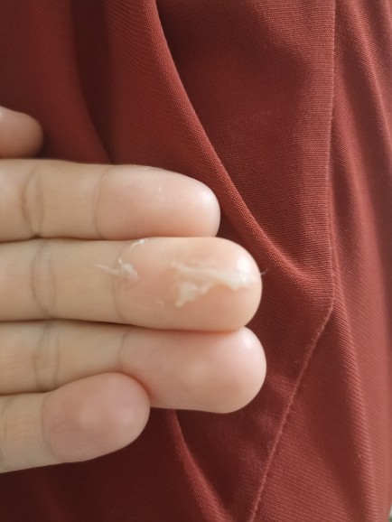 Diş fırçaladıktan sonra ağızda oluşan beyaz şey nedir?