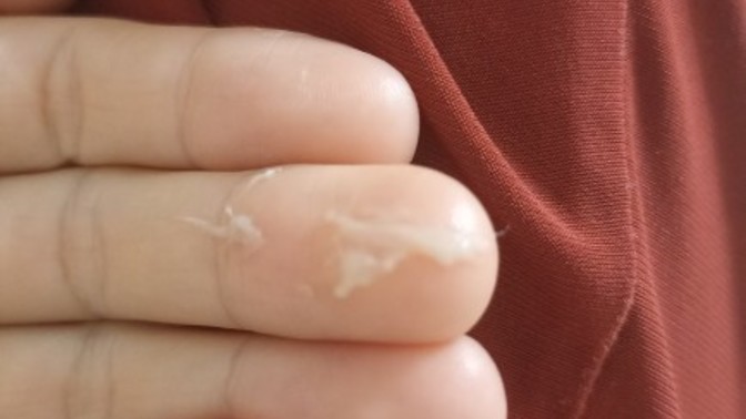 Diş fırçaladıktan sonra ağızda oluşan beyaz şey nedir?